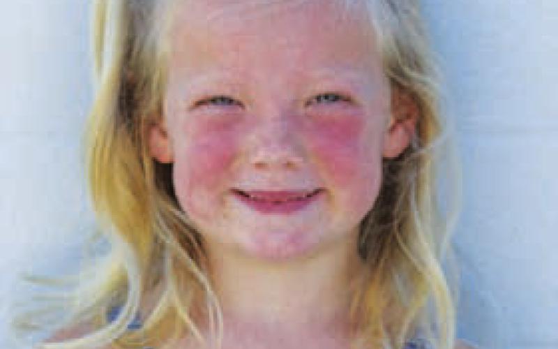 Oakley Yoho Age: 5 Parents: Jacob and Tori Yoho